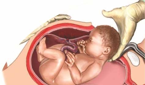 ObstetricsGynaecology